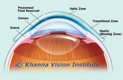 Best Vision Eye Care Center